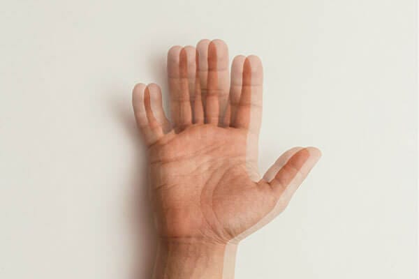 All You Need to Know About Double Vision (AKA Diplopia)