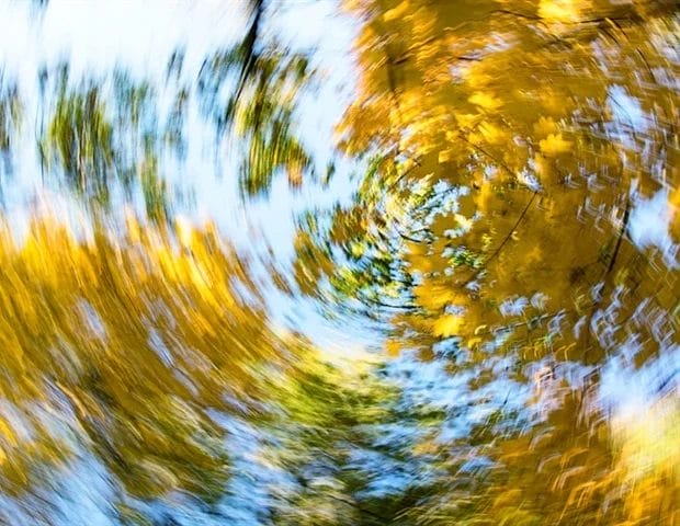 Visual Motion Sensitivity: Causes, Symptoms, Diagnosis, and Treatment ...