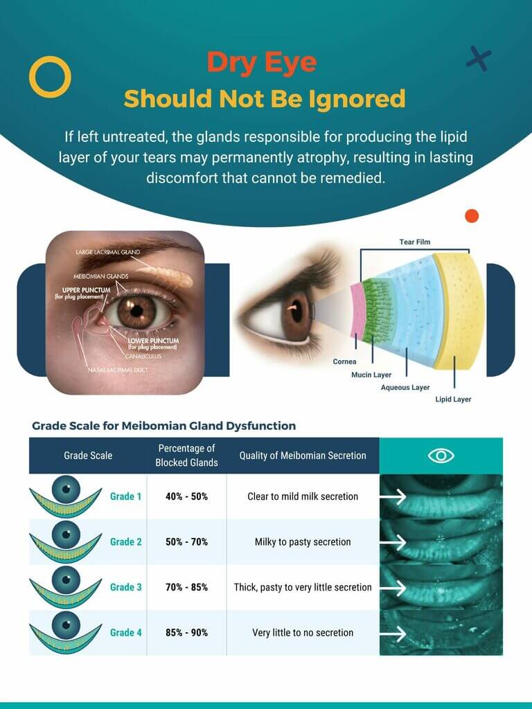 Dry Eye Posters Free Giveaway - Specialty Vision