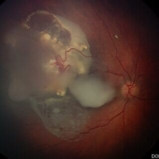 What Makes a “Dynamic” B-Scan Ultrasound Different?